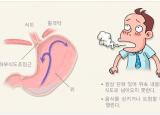 목에 이물감 - 역류성식도염 증상과 좋은음식